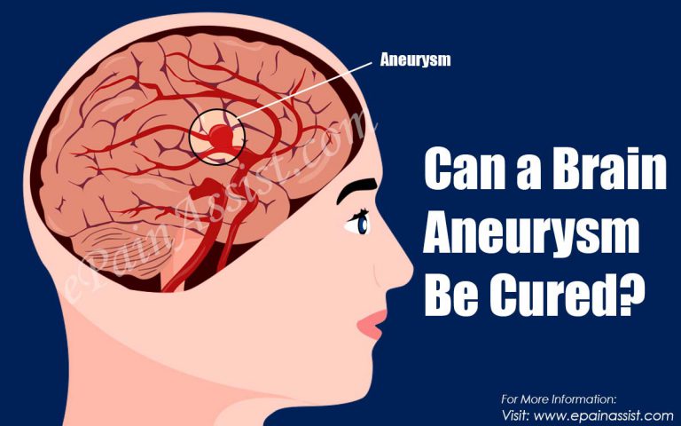 Can a Brain Aneurysm Be Cured?