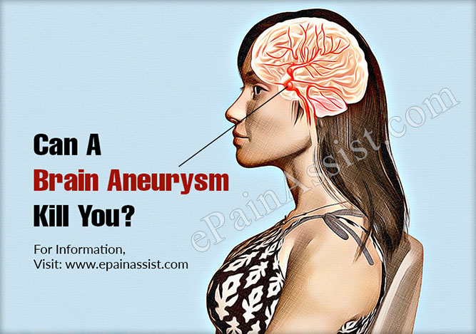 Can A Brain Aneurysm Kill You?