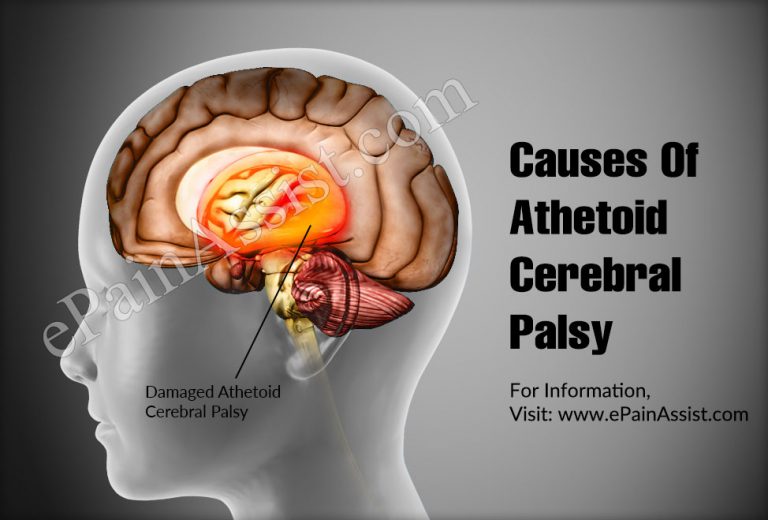 Causes Of Athetoid Cerebral Palsy