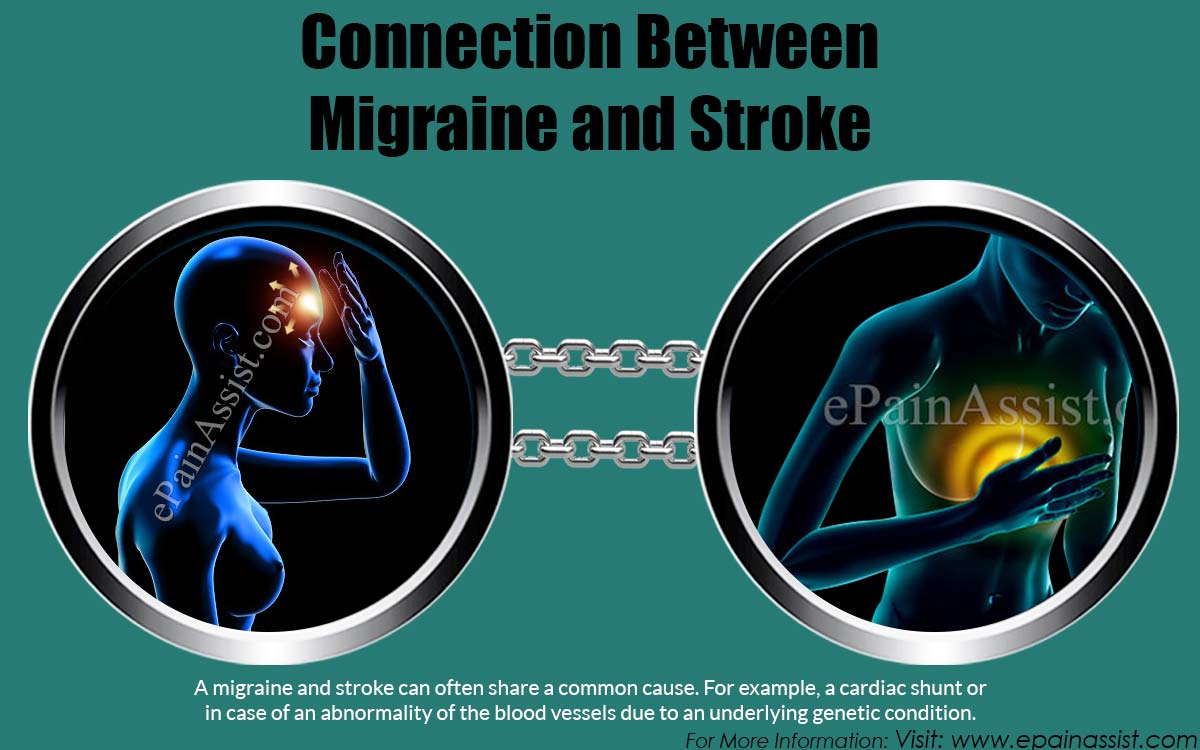 Connection Between Migraine and Stroke