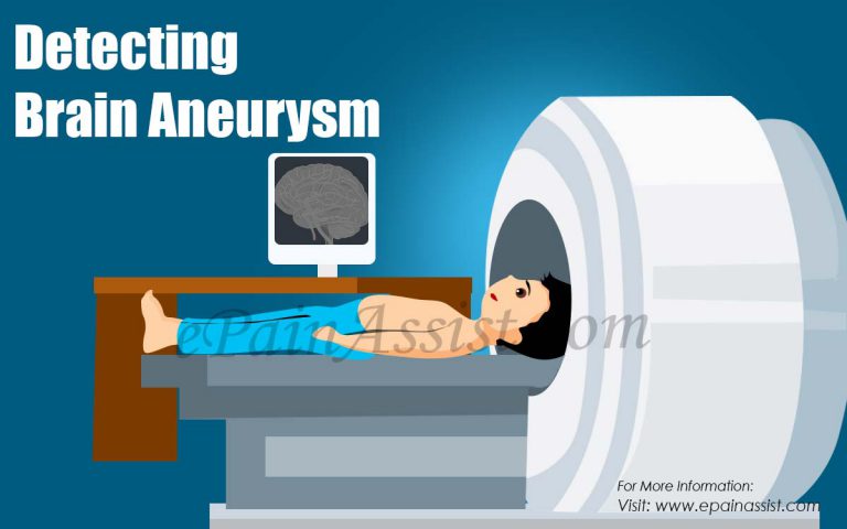 Detecting Brain Aneurysm: What Does It Feel Like When You Have A Brain Aneurysm?