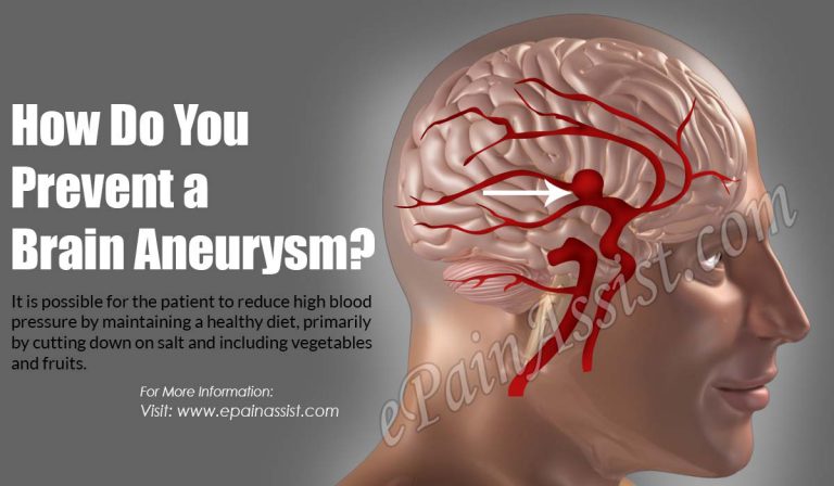 How Do You Prevent a Brain Aneurysm?