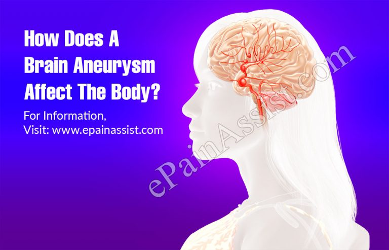 How Does A Brain Aneurysm Affect The Body?