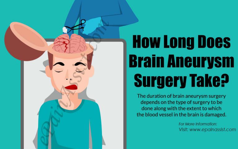 How Long Does Brain Aneurysm Surgery Take?