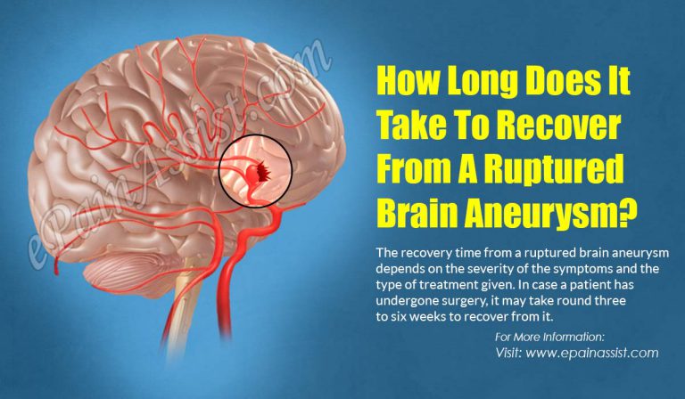 How Long Does It Take To Recover From A Ruptured Brain Aneurysm?