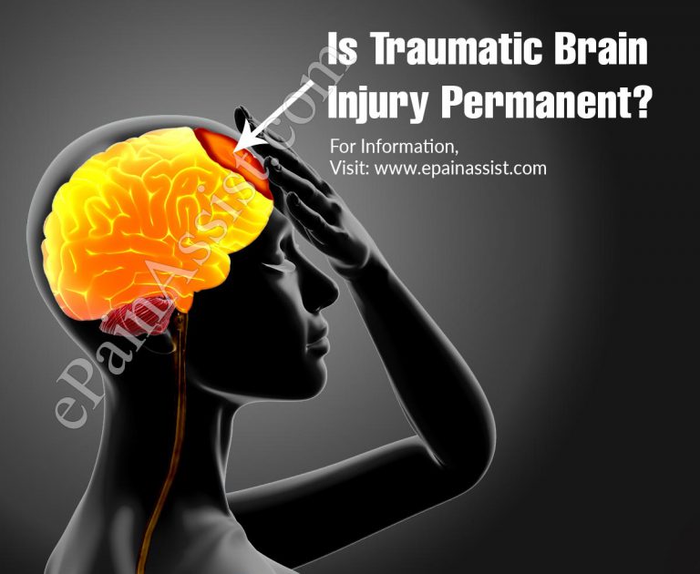 Is Traumatic Brain Injury Permanent?