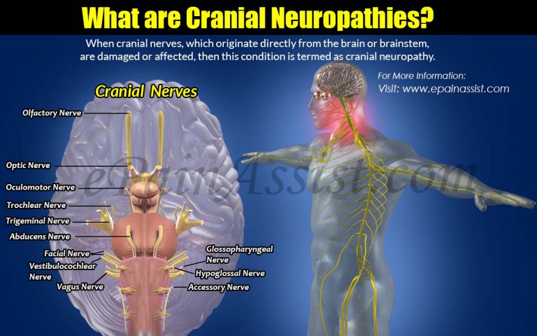 What are Cranial Neuropathies: Causes, Types, Symptoms, Treatment, Prevention