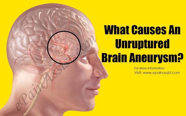 What Causes An Unruptured Brain Aneurysm?