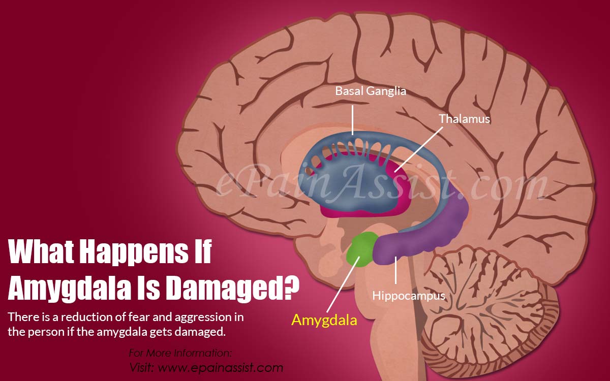 Labeled Brain Amygdala