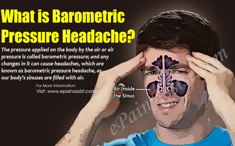 What is Barometric Pressure Headache: Causes, Symptoms, Treatment, Prevention