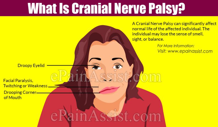 What is Cranial Nerve Palsy & What Causes Cranial Nerve Palsy?