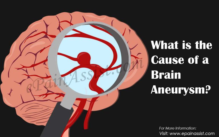 What are the Symptoms Of An Unruptured Brain Aneurysm?