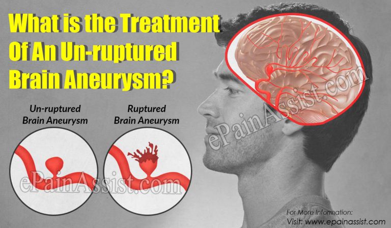 What is the Treatment Of An Un-ruptured Brain Aneurysm?
