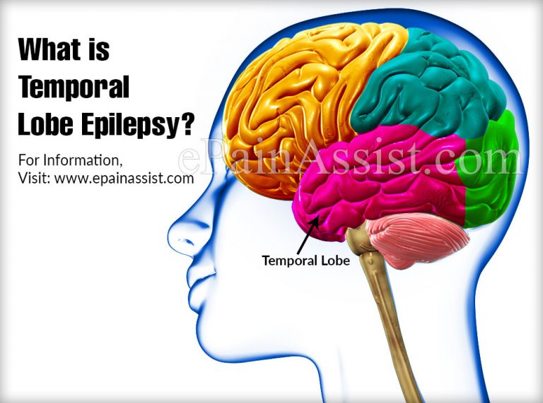Temporal Lobe Epilepsy: Causes, Signs, Symptoms, Treatment, Diagnosis