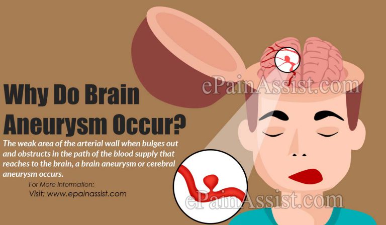 Why Do Brain Aneurysm Occur?