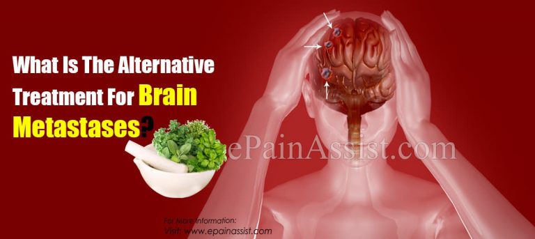 What Is The Alternative Treatment For Brain Metastases?