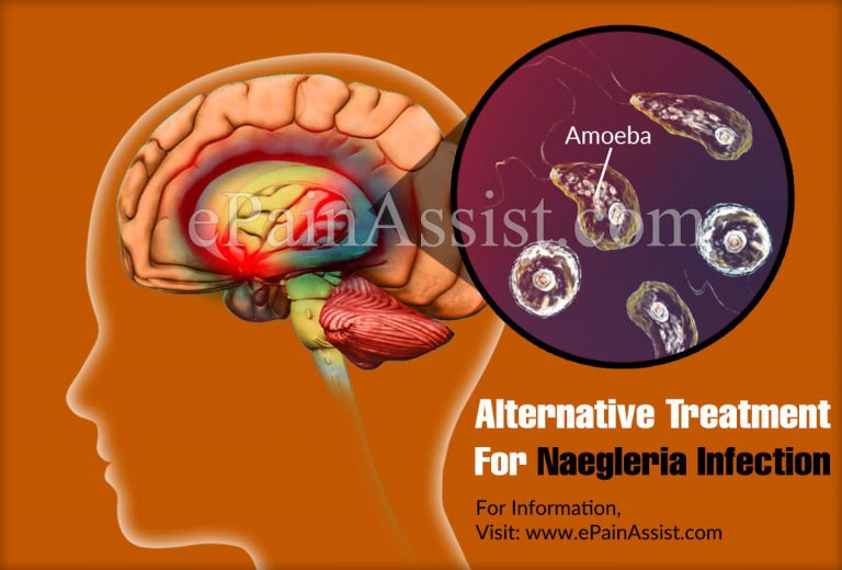 Alternative Treatment For Naegleria Infection