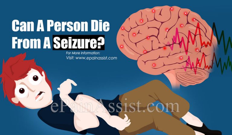 Can A Person Die From A Seizure?
