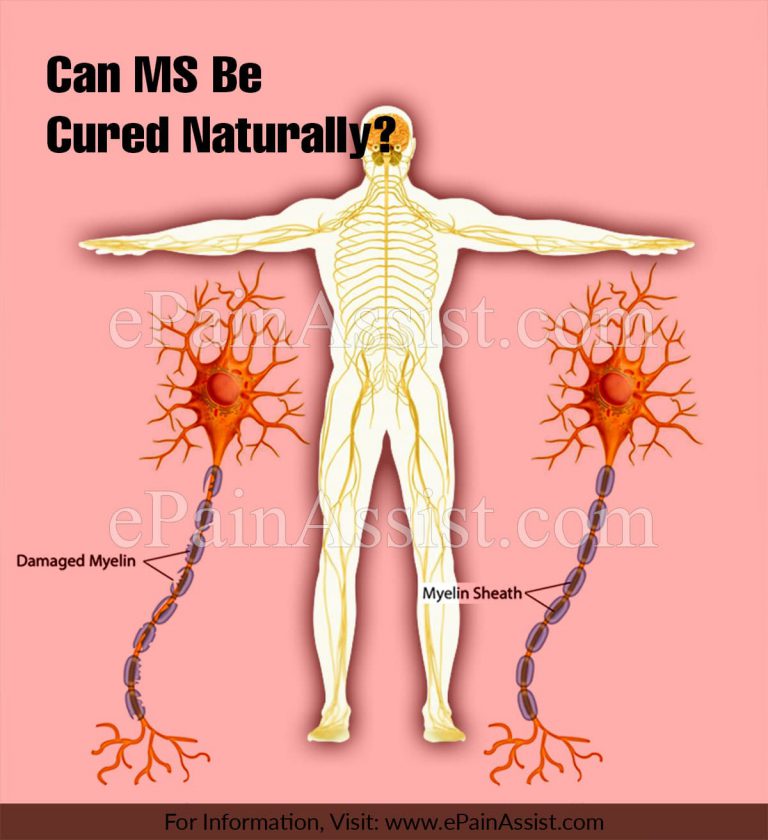 Can MS Be Cured Naturally?