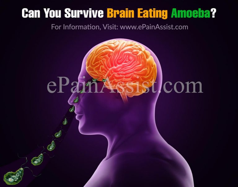 Can You Survive Brain Eating Amoeba?