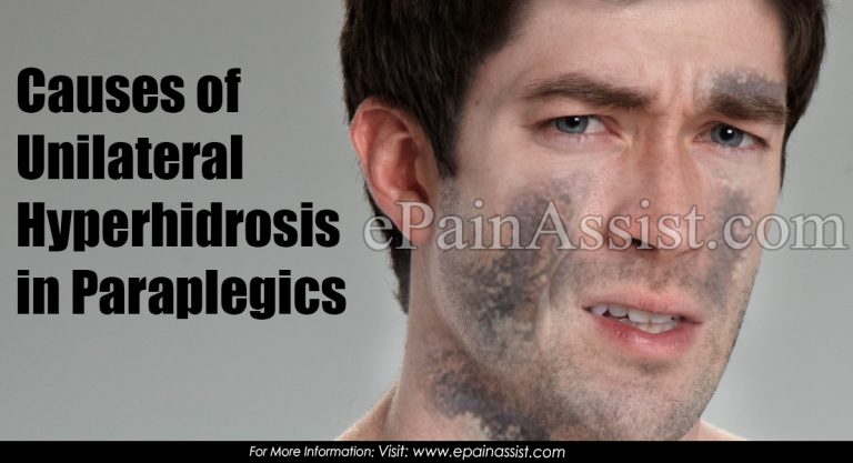 Causes of Unilateral Hyperhidrosis in Paraplegics & Its Treatment-Case Study