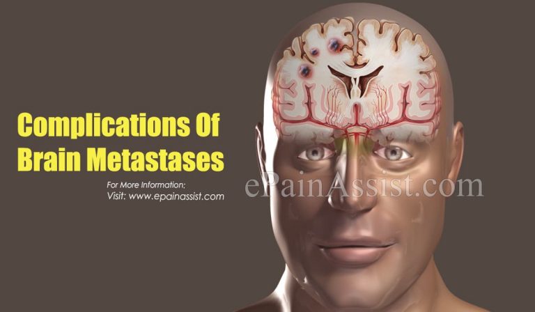 Complications Of Brain Metastases