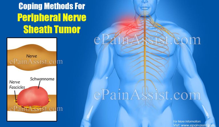 Coping Methods For Peripheral Nerve Sheath Tumor
