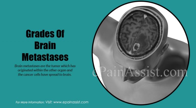 Grades Of Brain Metastases