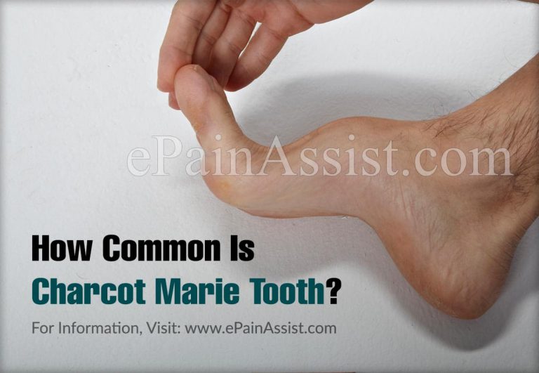 How Common Is Charcot Marie Tooth Or Is It A Rare Disease?