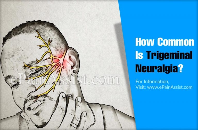 How Common Is Trigeminal Neuralgia Or Is It A Rare Disease?