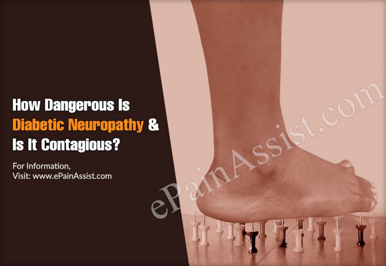 How Dangerous Is Diabetic Neuropathy & Is It Contagious?