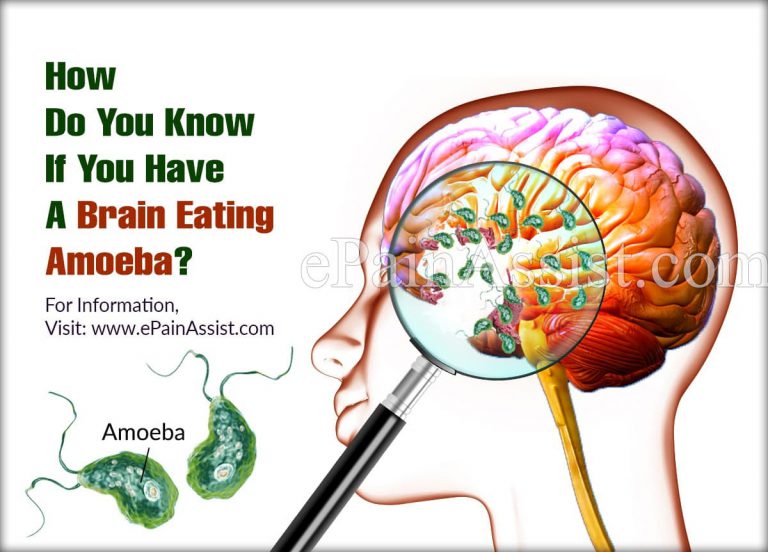 How Do You Know If You Have A Brain Eating Amoeba?