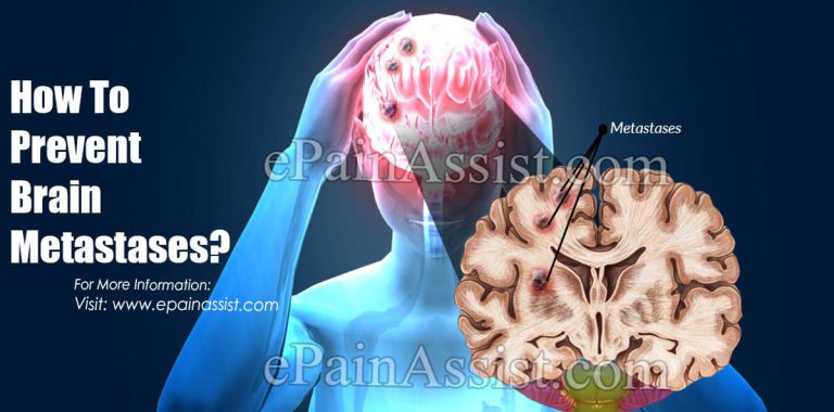 How To Prevent Brain Metastases?