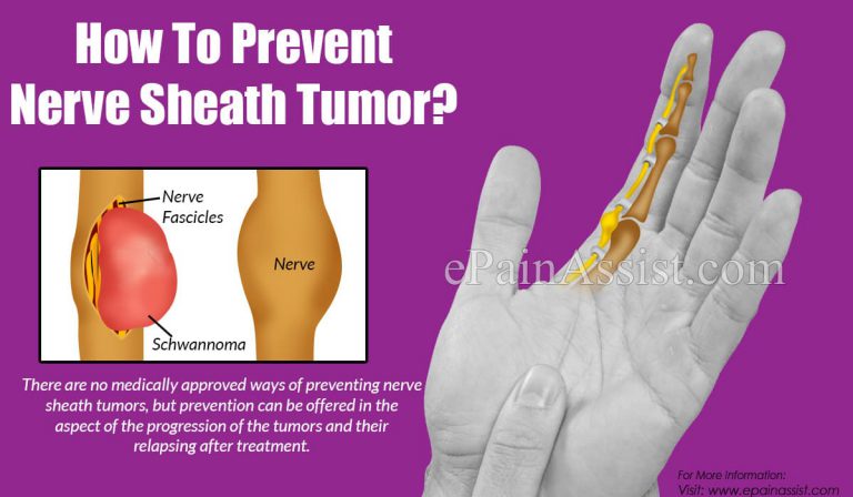 How To Prevent Nerve Sheath Tumor?