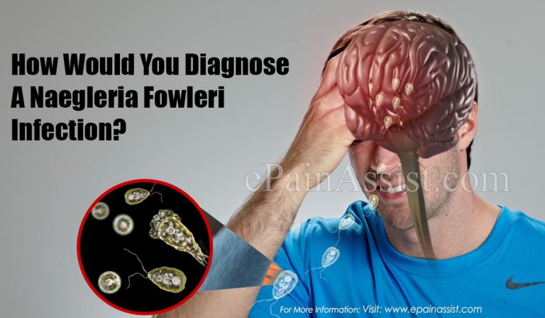 How Would You Diagnose A Naegleria Fowleri Infection?