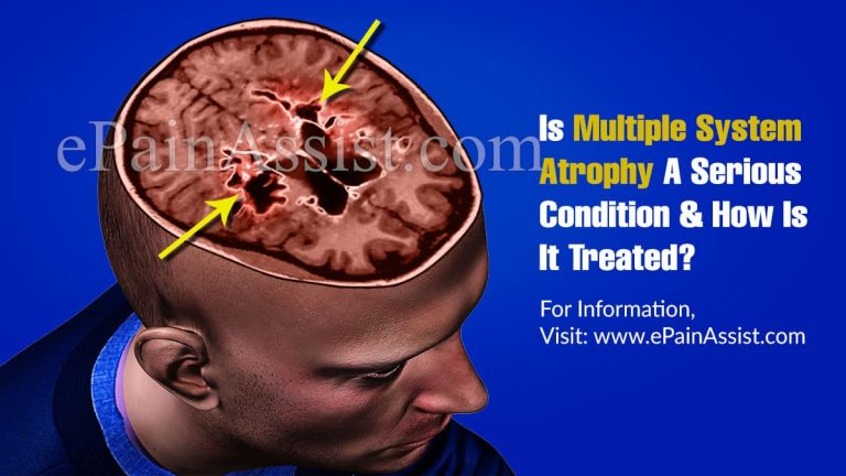 Is Multiple System Atrophy A Serious Condition & How Is It Treated?