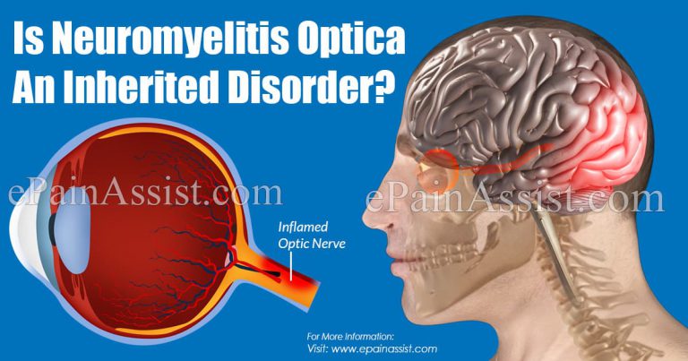 Is Neuromyelitis Optica An Inherited Disorder?