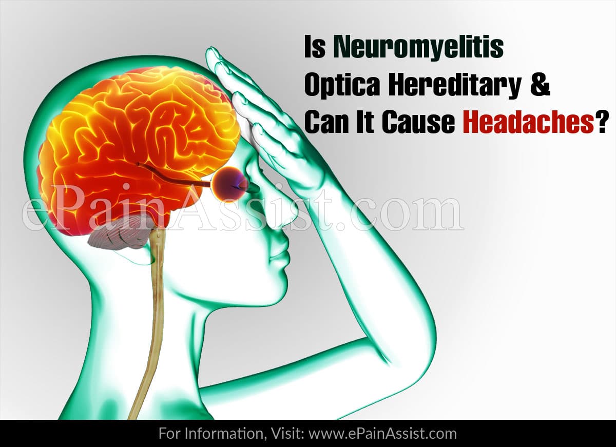 Is Neuromyelitis Optica Hereditary & Can It Cause Headaches?