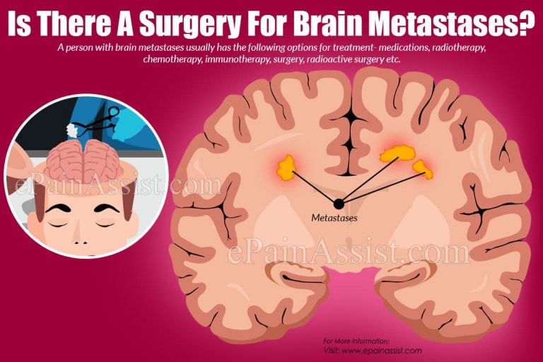 Is There A Surgery For Brain Metastases?
