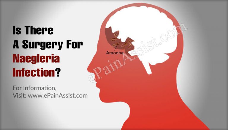 Is There A Surgery For Naegleria Infection?