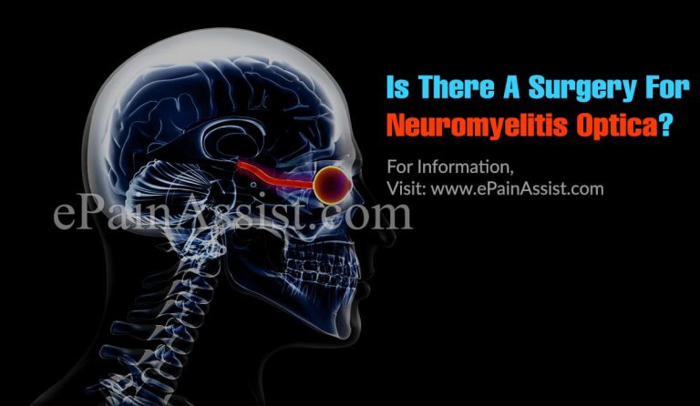 Is There A Surgery For Neuromyelitis Optica?