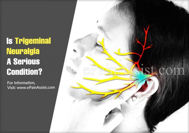 Is Trigeminal Neuralgia A Serious Condition & Can It Be Reversed?