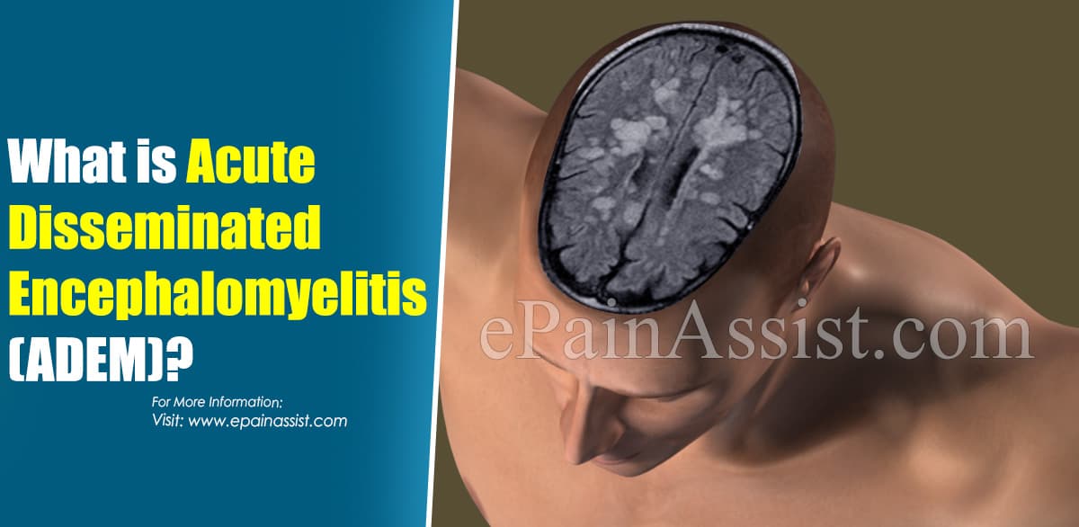 What is Acute Disseminated Encephalomyelitis (ADEM)?