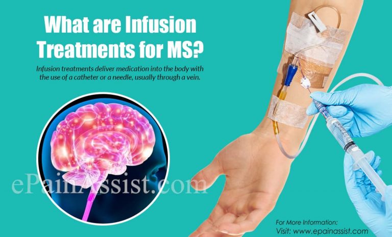 What are Infusion Treatments for MS?