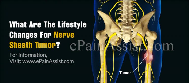 What Are The Lifestyle Changes For Nerve Sheath Tumor?