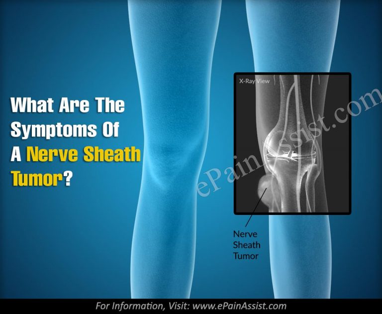 What Are The Symptoms Of A Nerve Sheath Tumor?