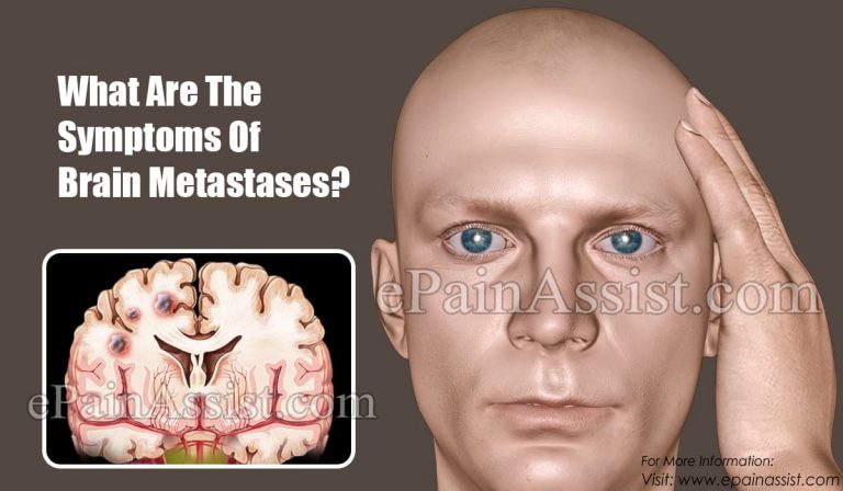 What Are The Symptoms Of Brain Metastases?