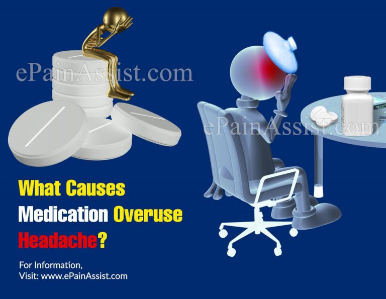 What Causes Medication Overuse Headache?