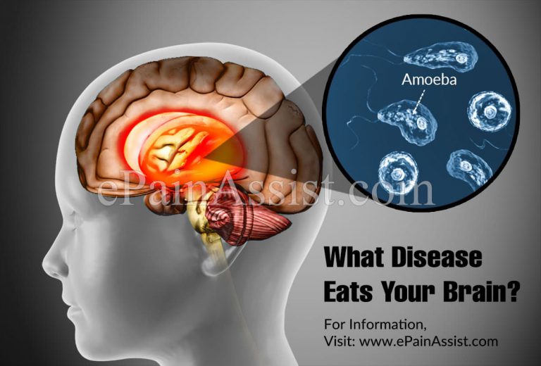 What Disease Eats Your Brain?