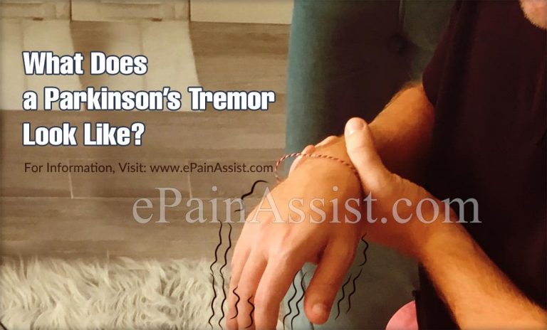 What Does a Parkinson’s Tremor Look Like?